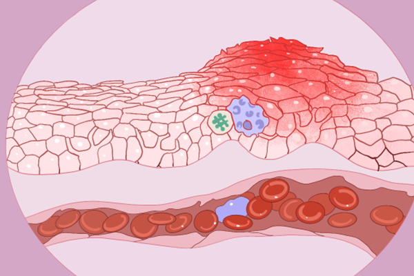 ����֭������ ����֭����������Щ